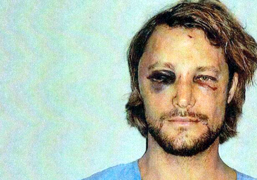 Gabriel Aubry Injuries